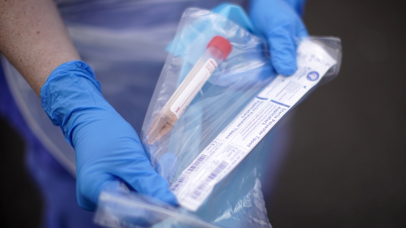 Iceland has confirmed 1,801 cases of Covid-19 and recorded 10 deaths