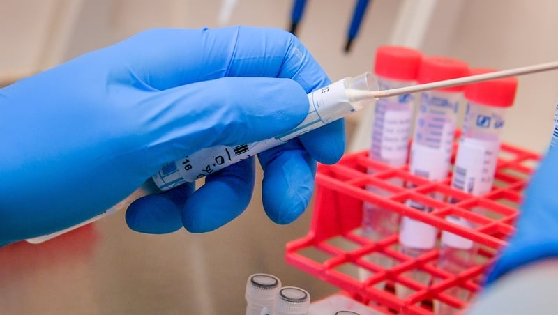 There are currently more people who need to be tested than there is availability