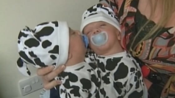 Conjoined twins Hassan and Hussein Benhaffaf (2010)