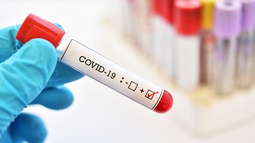There has now been 25,498 cases of the coronavirus here in Ireland