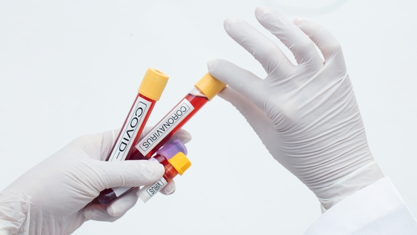 Global deaths linked to the coronavirus have now passed 200,000