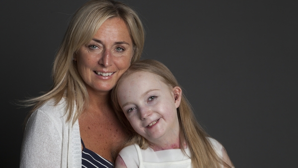 Liz Collins and her daughter Claudia Scanlon who has EB