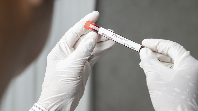 29 eile básaithe le Covid-19 sa Stát