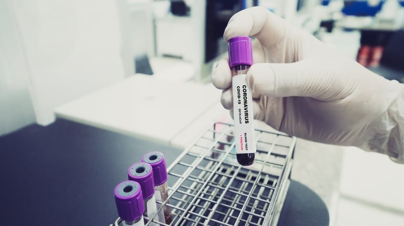 A further 13 cases of the coronavirus have been diagnosed in the Republic