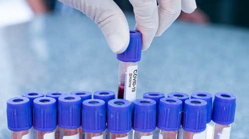 There are now 25,219 Covid-19 cases in the Republic