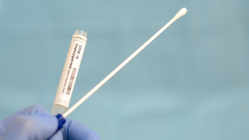 Patients using some private hospitals are facing fees of up to €250 for a coronavirus test