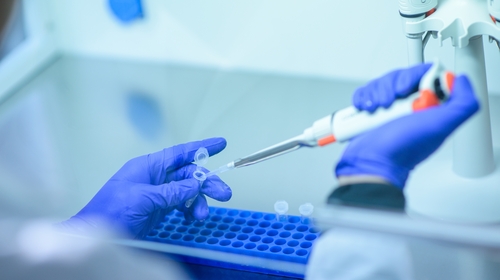 There were 11 new cases of Covid-19 confirmed in Ireland