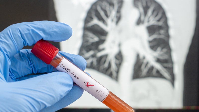 There are now a total of 113,322 confirmed Covid-19 cases in Ireland