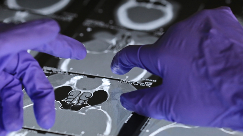 The HSE said the impact of Covid-19 on services had been significant