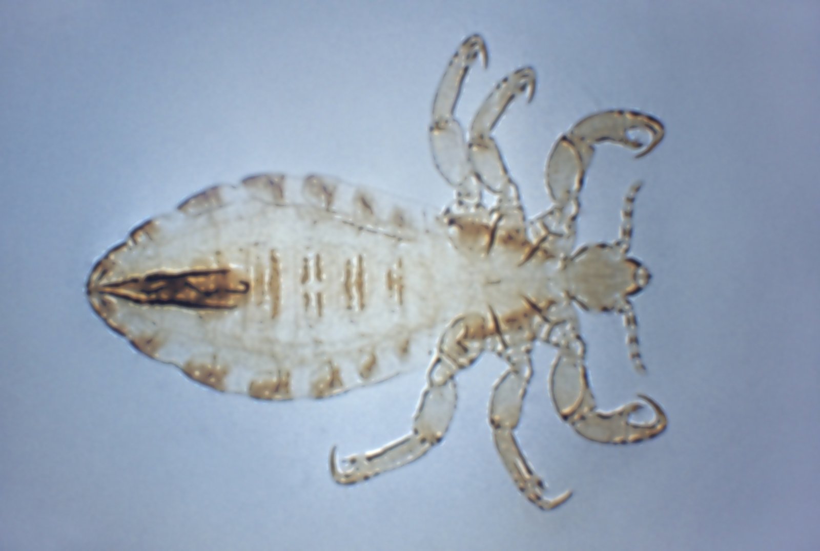 Morphological characteristics of the body louse (Pediculus humanus corporis), carriers of the epidemic typhus, trench fever, and relapsing fever, 1972. Image courtesy Centers for Disease Control (CDC). Source:Collection/Gado/Getty Images