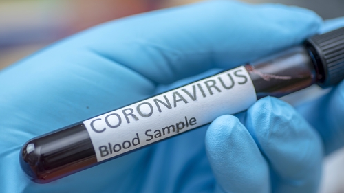 The total number of coronavirus-related deaths in Ireland remains at 1,777