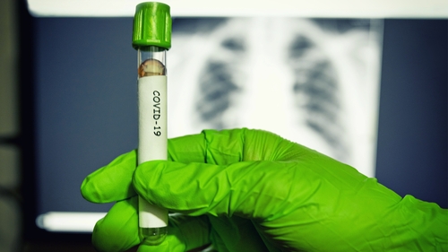 There were no further deaths and 38 new cases from coronavirus reported in the past 24 hours