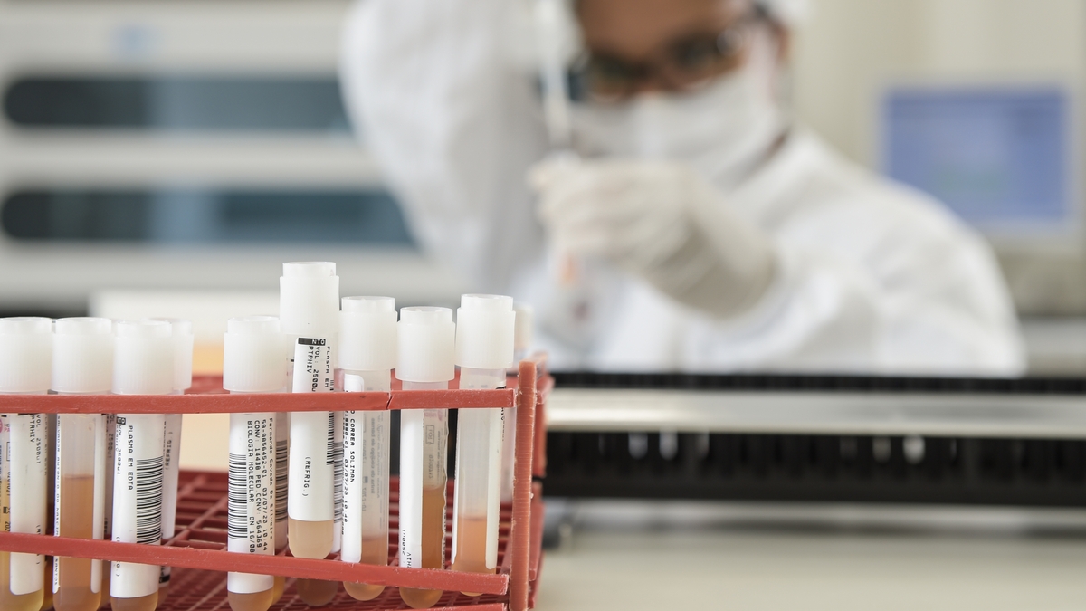 How to go about living with Covid-19 