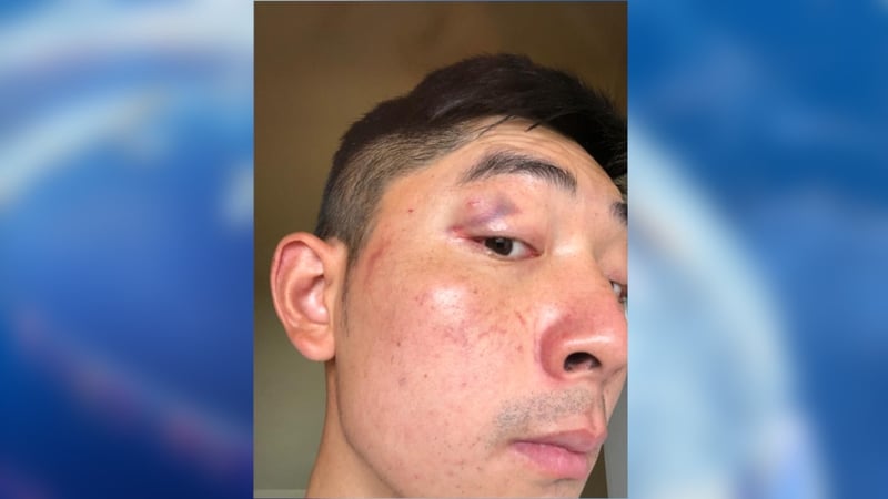 Martin Hong and his friend were treated at Cork University Hospital