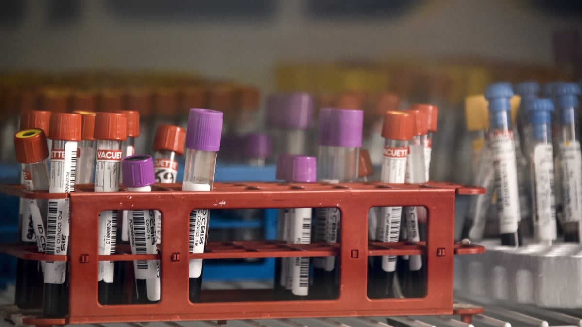 Medical Laboratory Scientists taking industrial action