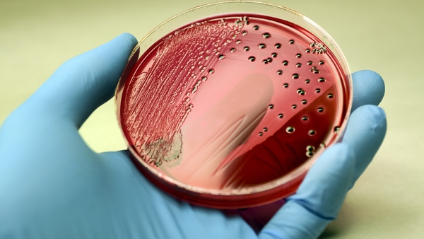 "Since the course of sepsis is characterised by hyper-inflammation, maybe we can use a worm's know-how to counteract this?" Photo: Getty Images