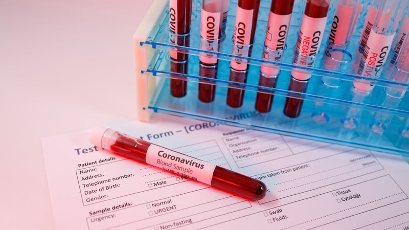 Between last Friday and Sunday more than 3,000 Covid-19 cases were confirmed