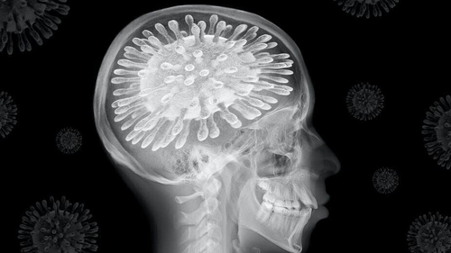 Whether we've caught it or not, the coronavirus is affecting our brains. Photo: Teo Tarras/ Shutterstock