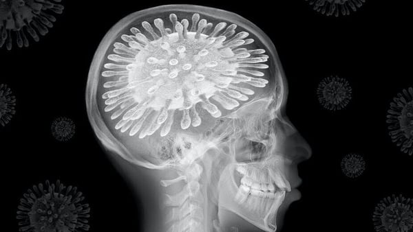 Whether we've caught it or not, the coronavirus is affecting our brains. Photo: Teo Tarras/ Shutterstock