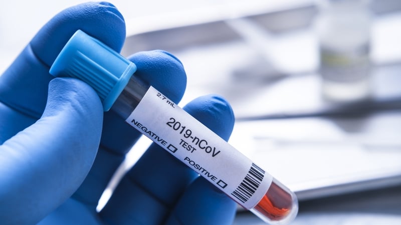 The figures come as the HSE warned we are at a concerning crossroads with the virus