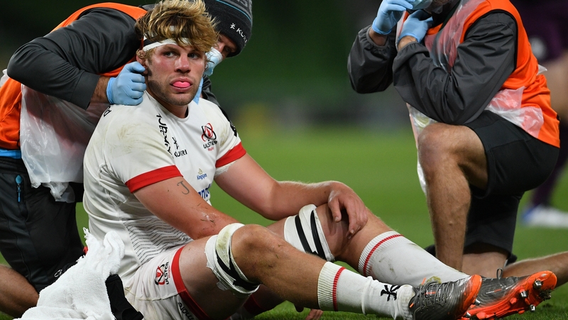 Jordi Murphy is a doubt for Saturday