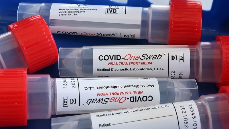 Covid-19 tolgtha ag 33,994 duine sa Phoblacht