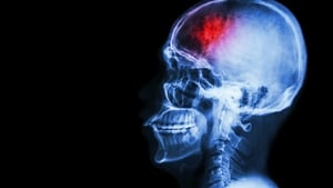 Every Second Counts - New HSE Stroke campaign show image