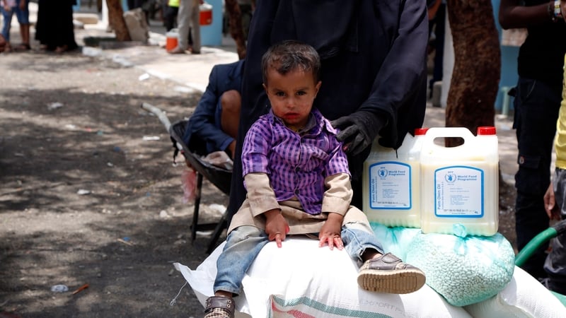 A Yemeni child from a family who was affected by more than 4-years of conflicts, sits on a food ration received from the World Food Programme