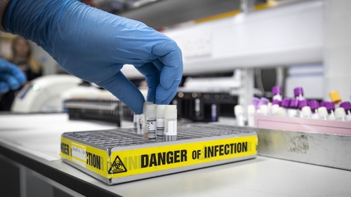 The number of people being treated in intensive care units is 34, unchanged from yesterday