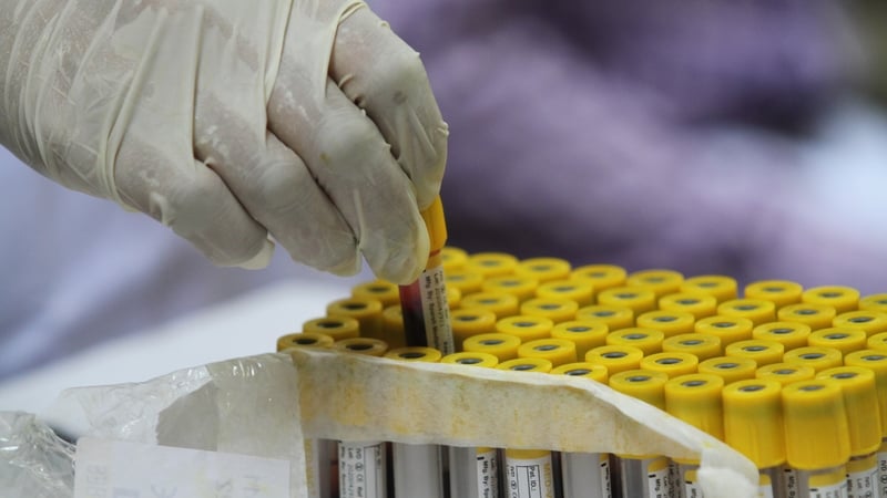 The study, which has yet to be peer reviewed, involved more than 365,000 randomly selected adults