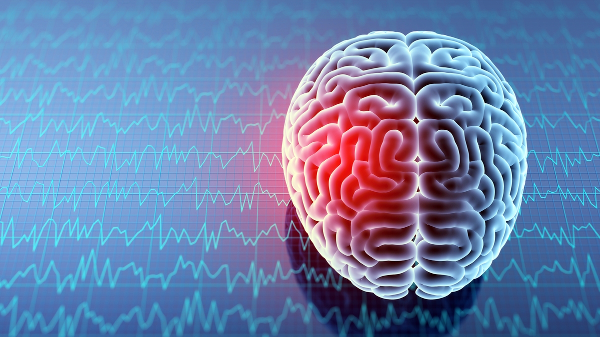 Concussions – how to spot them on the side line