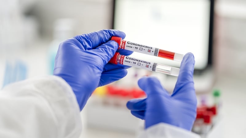 There have now been 85,394 confirmed cases of Covid-19 in Ireland