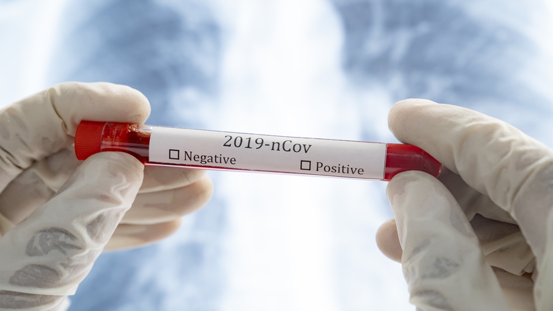 Of the deaths notified today, 29 occurred in February and six in January (File pic, Getty Images)