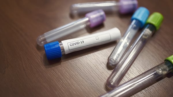 "We have seen with SARS-CoV2 that vaccines have emerged based on this virus's spike protein, which is key to viral infection."