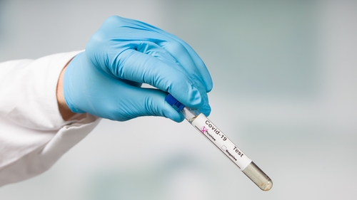 The cumulative number of cases since the pandemic began is 248,326