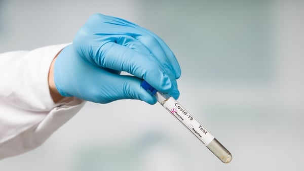 The cumulative number of cases since the pandemic began is 248,326