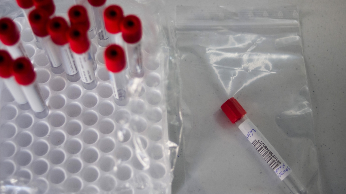 Covid 19: Extending Vaccine Dose Intervals