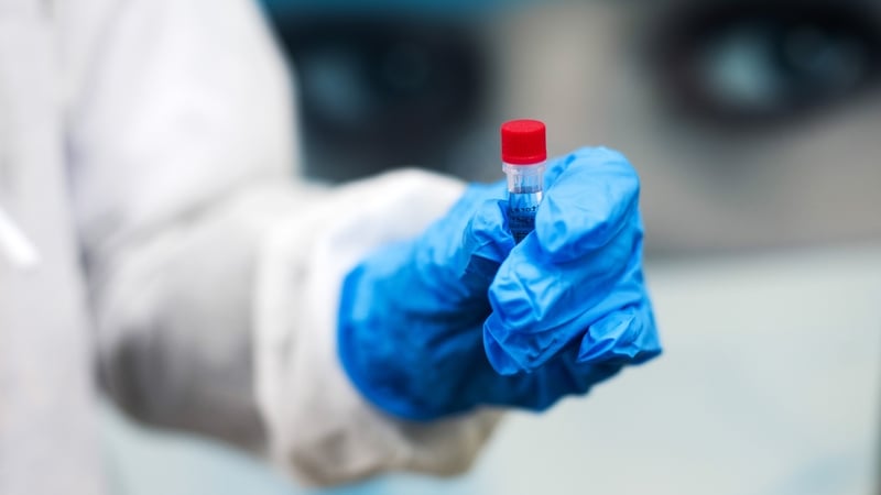 Covid-19: ochtar eile básaithe, 309 cás nua