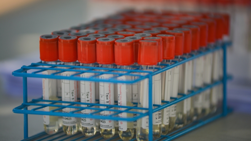 Covid-19: triúr eile básaithe, 474 cás nua