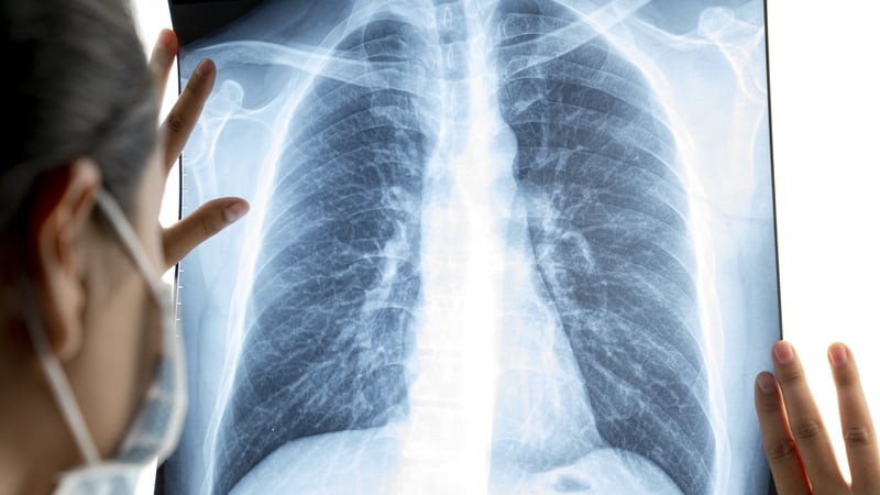 There has been widespread cancellation of radiology services