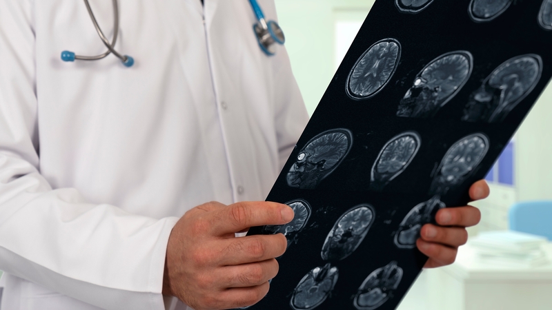 Oncologist warns over delays to cancer diagnosis and treatment (stock image)