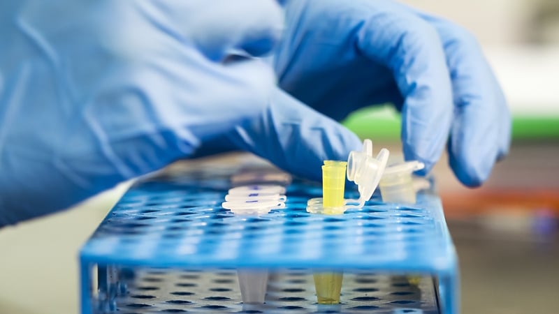 Forensic Science Ireland is working to build up a DNA database of missing persons and unidentified bodies