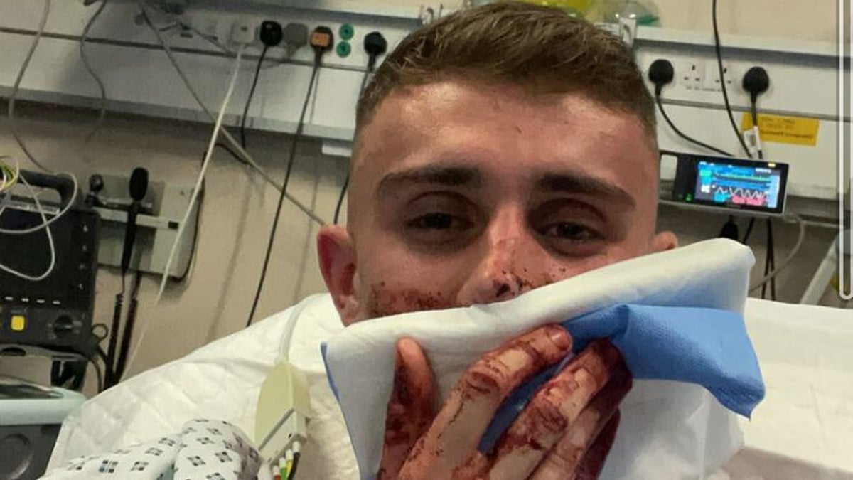 Irish Olympian Jack Woolley injured in Dublin incident