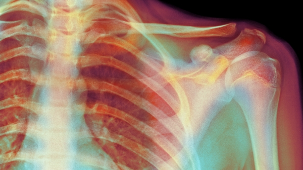 'The relationship between 'damage' on scans and pain is not a straightforward one'. Photo: Getty Images