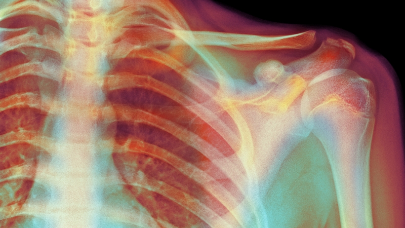 'The relationship between 'damage' on scans and pain is not a straightforward one'. Photo: Getty Images