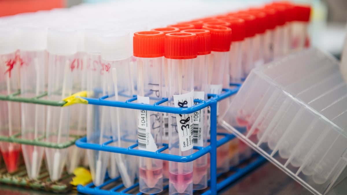 Over 23,000 new Covid-19 cases reported in Ireland yesterday