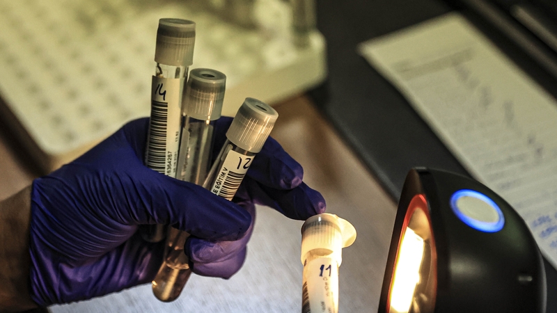 The report says saliva screening is a less invasive alternative to the nasal/throat swab