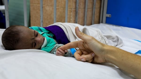 A child lies in a malnutrition treatment ward at the Indira Gandhi Children's Hospital in Kabul (pic: UNICEF)