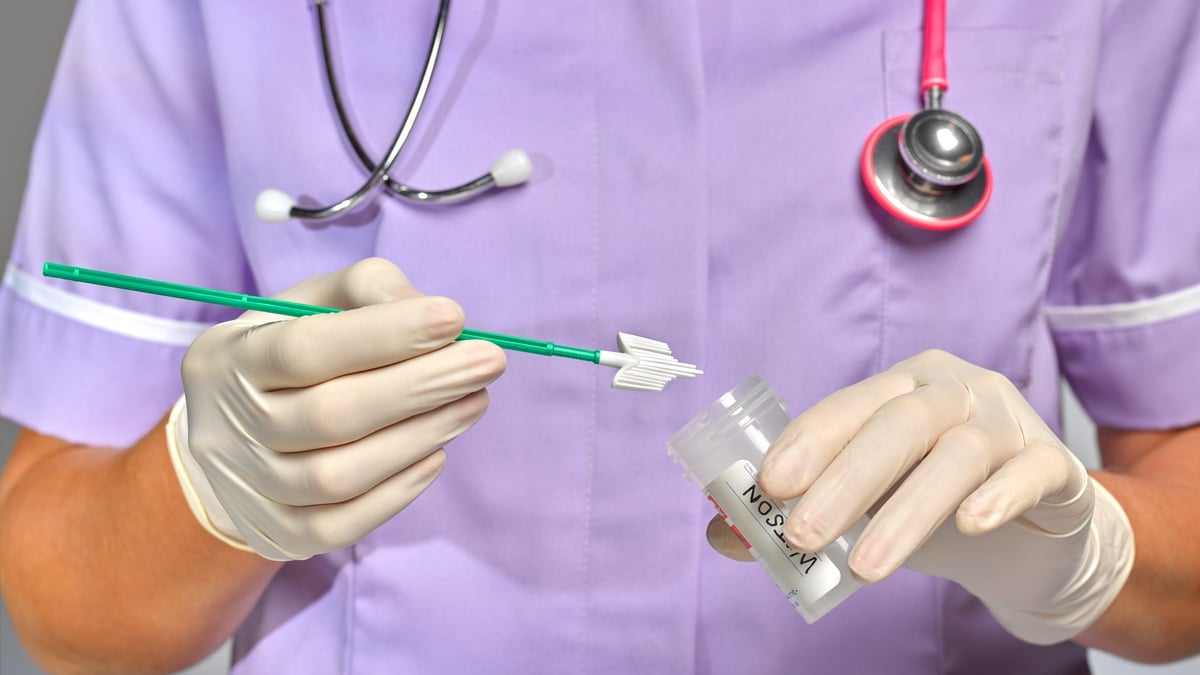 CervicalCheck to roll out DIY home smear tests