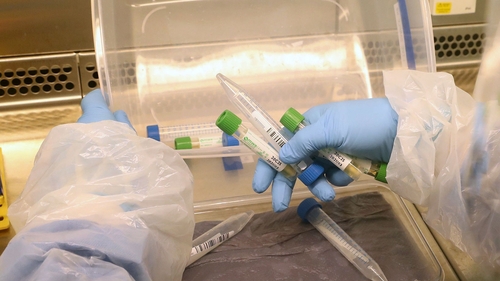 Damien McCallion said positive cases will be routed to the National Virus Reference Laboratory for further testing